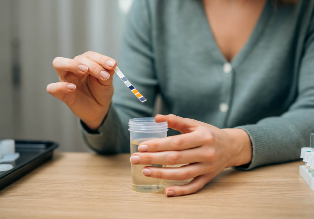 A woman holding a urine test strip on her right hand over the urine cup on his left hand