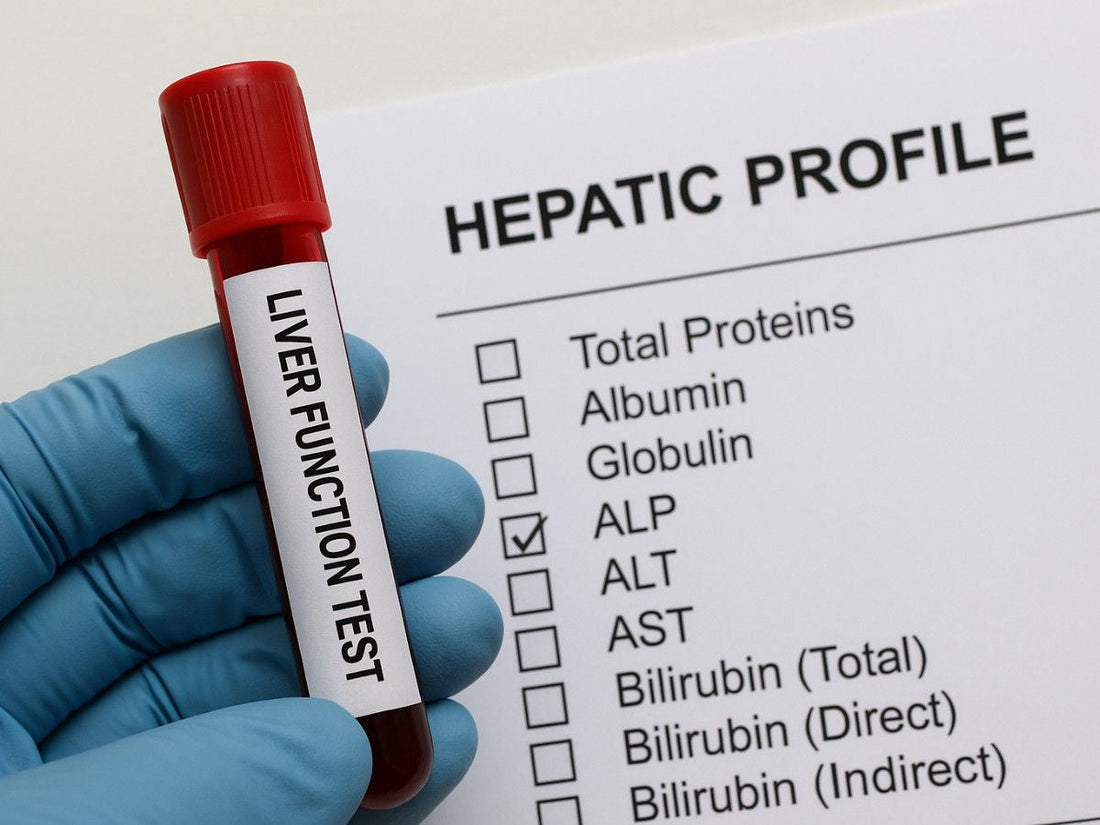 How to Order Liver Function Test: A Step-by-Step Guide