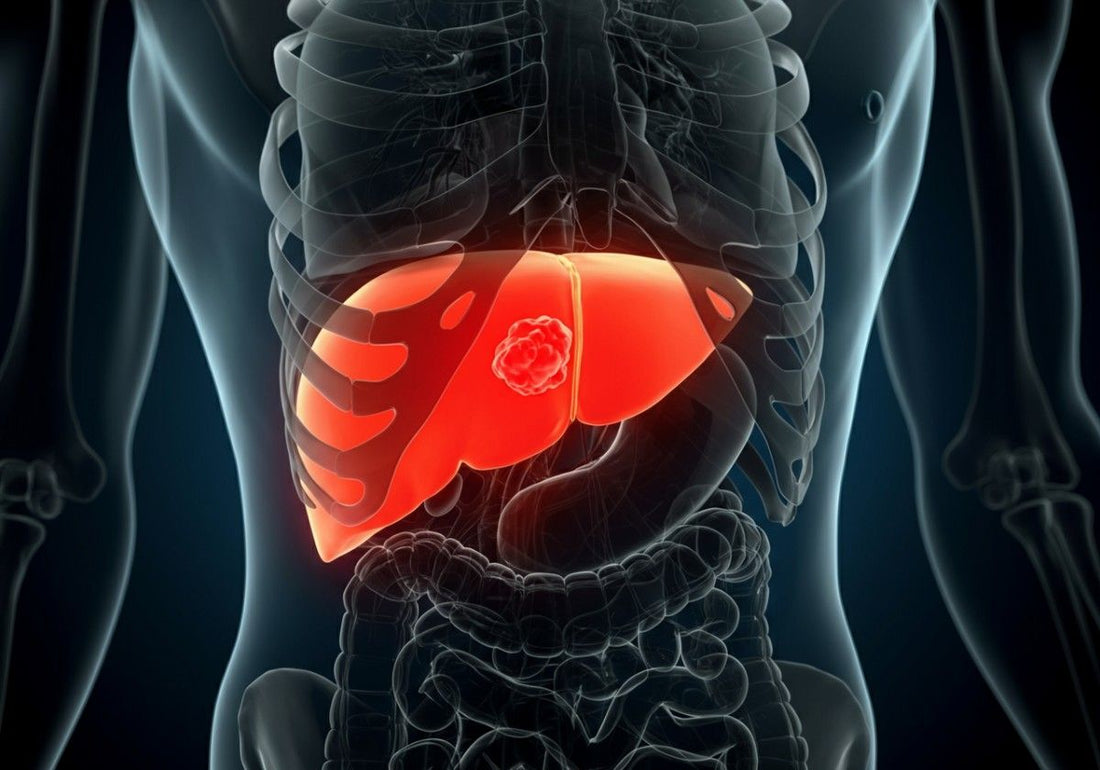 Liver Cancer Survival Rate: What You Need to Know