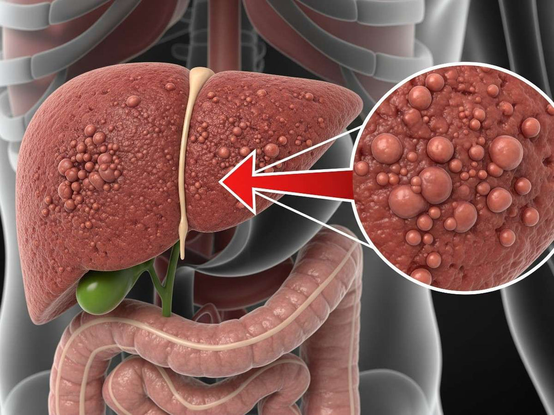 Liver Cancer Progression Without Treatment: How Fast Does It Spread?