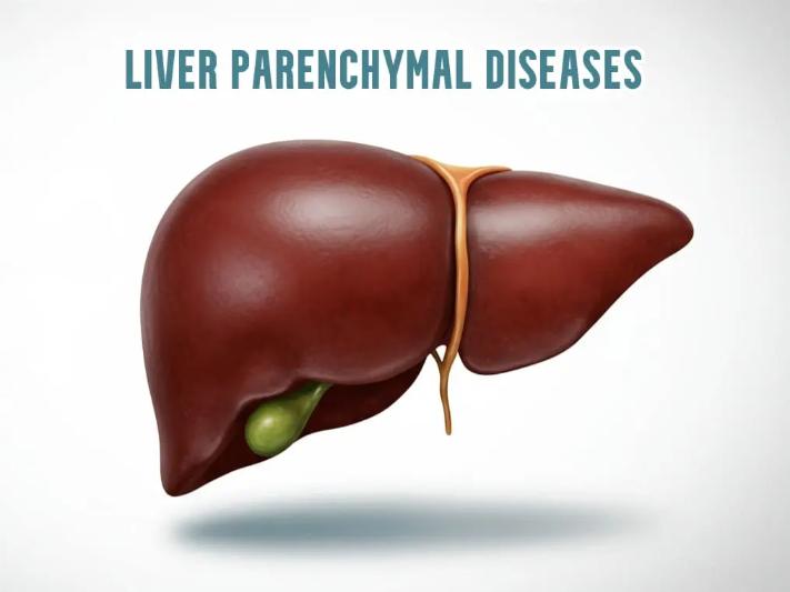 Hepatic Parenchymal Disease: Conditions, Symptoms, And Treatment