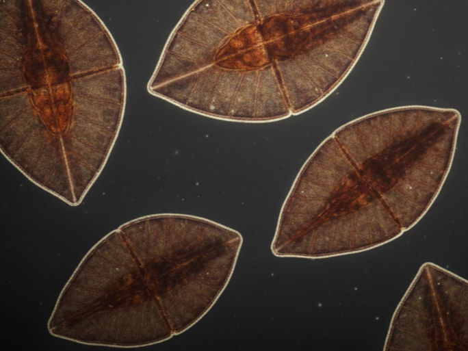 What Are Liver Flukes?