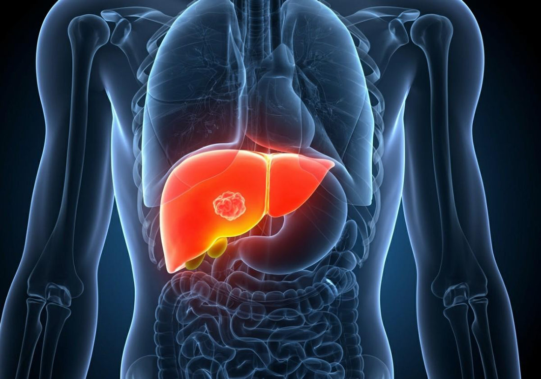Stage 4 Liver Cancer: What You Need to Know