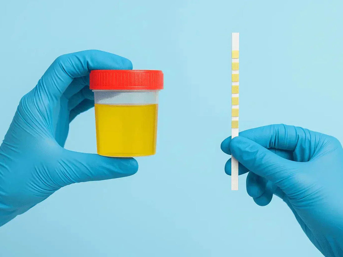 Urine Test Strips for Protein: Results, Accuracy: When to See a Doctor