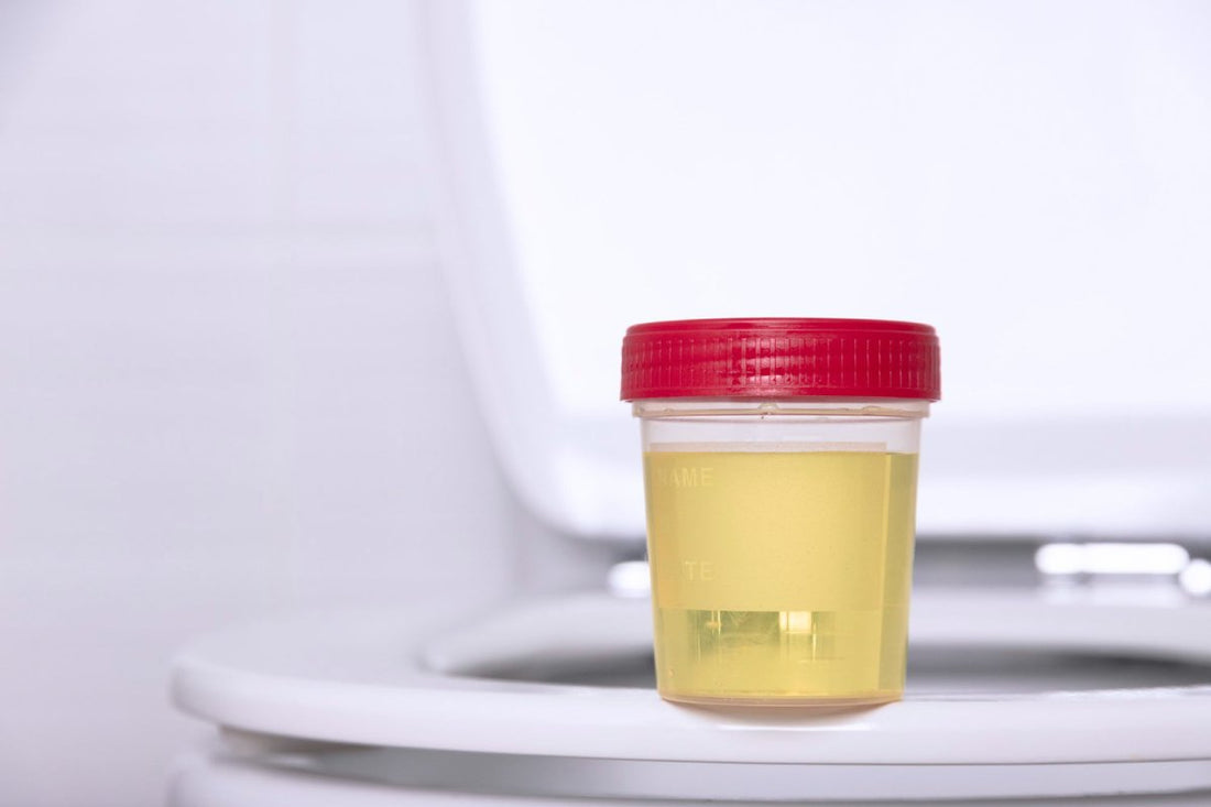 urine sample