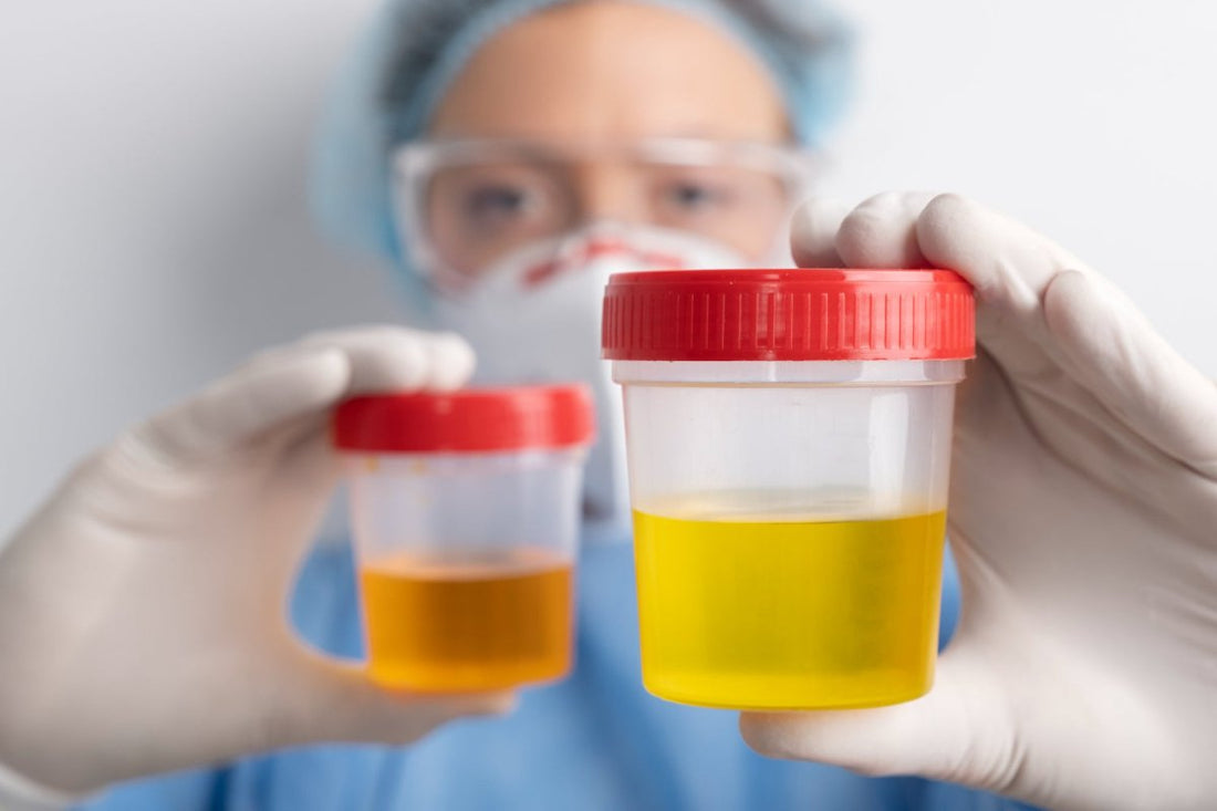 urinalysis