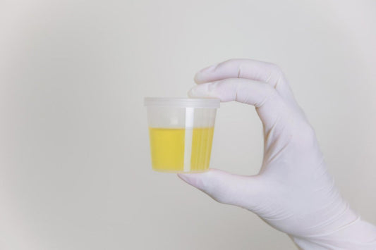 24-Hour Urine Collection. How To Do It Properly?