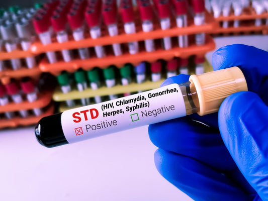 At-Home STD Tests: Safety and Effectiveness