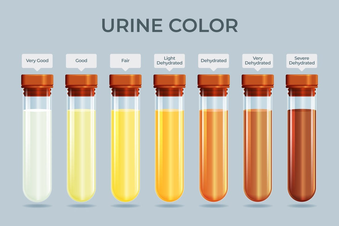 color of urine chart