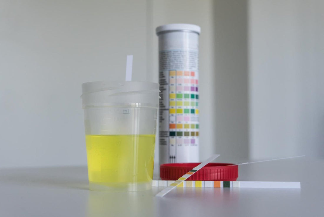 rapid urine test