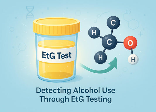 How Long Can Alcohol Be Detected in Urine EtG Testing?