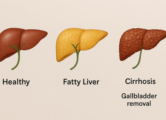 Liver Cirrhosis After Gallbladder Removal: Risks, Symptoms, and Prevention
