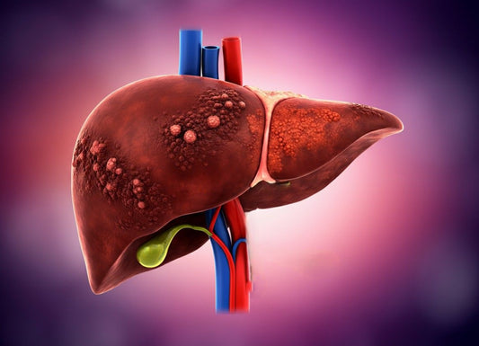 Is Cirrhosis of the Liver Cancer?