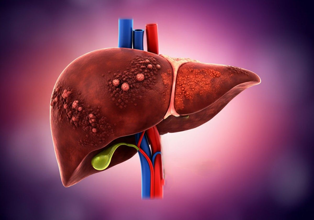 Is Cirrhosis of the Liver Cancer?