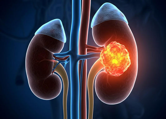 Kidney Cancer Survival Rate by Stage