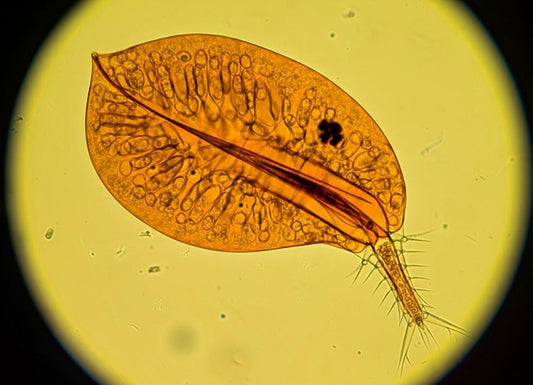 Liver Flukes in Toilet: What It Means and When to Worry