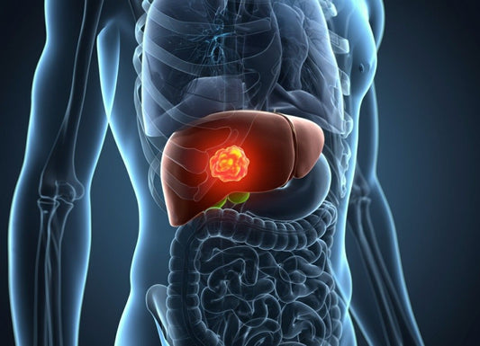 What Causes Small Lesions on the Liver? Symptoms, Diagnosis, and Treatment