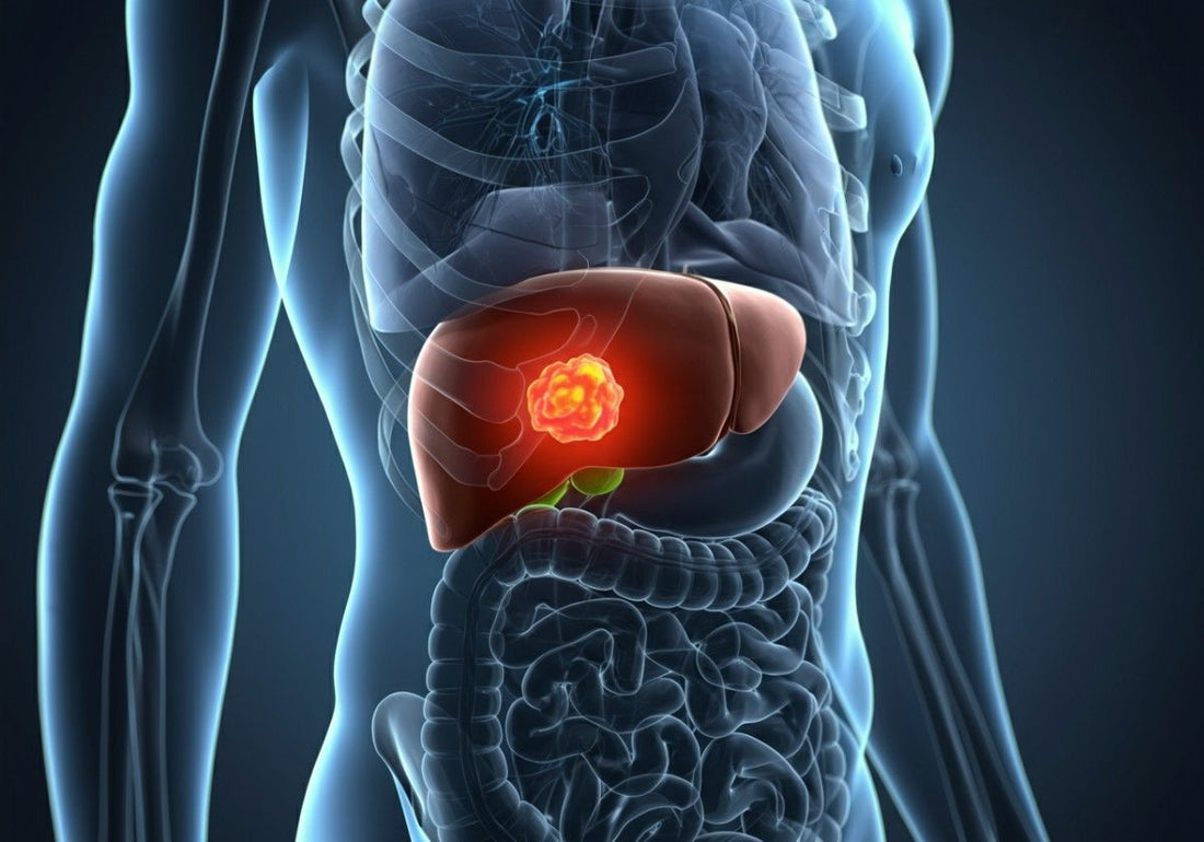 What Causes Small Lesions on the Liver? Symptoms, Diagnosis, and Treatment