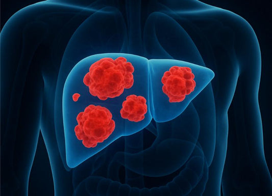 When Colon Cancer Spreads to the Liver: A Complete Guide