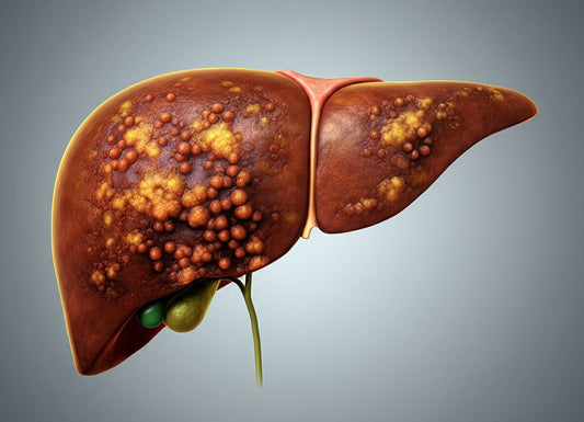 Signs of Liver Disease