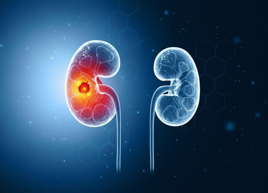Early Symptoms of Kidney Cancer: Top Warning Signs