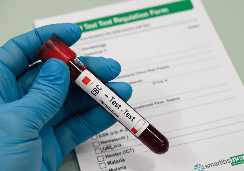Does a CBC Test Check Liver and Kidney Function? What You Need to Know