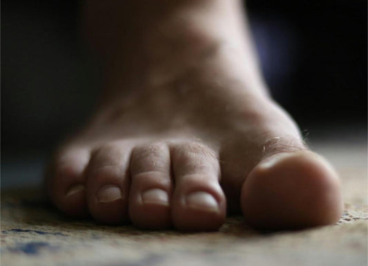 Diabetes Dry Feet: What It Means and How to Treat It