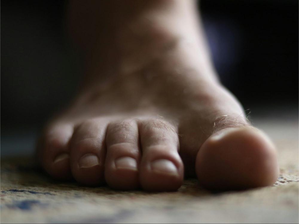 Diabetes Dry Feet: What It Means and How to Treat It