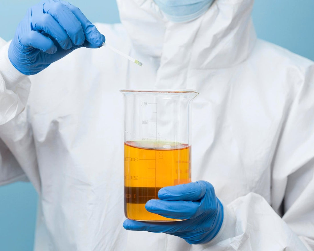 Urine Specific Gravity: Normal Levels & Impact on Health