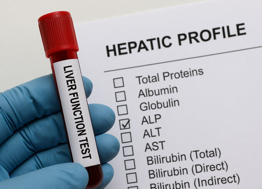 How to Order Liver Function Test: A Step-by-Step Guide