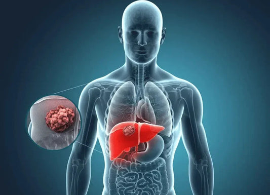 What Percentage of Liver Tumors Are Benign? What Your Scan Might Really Mean