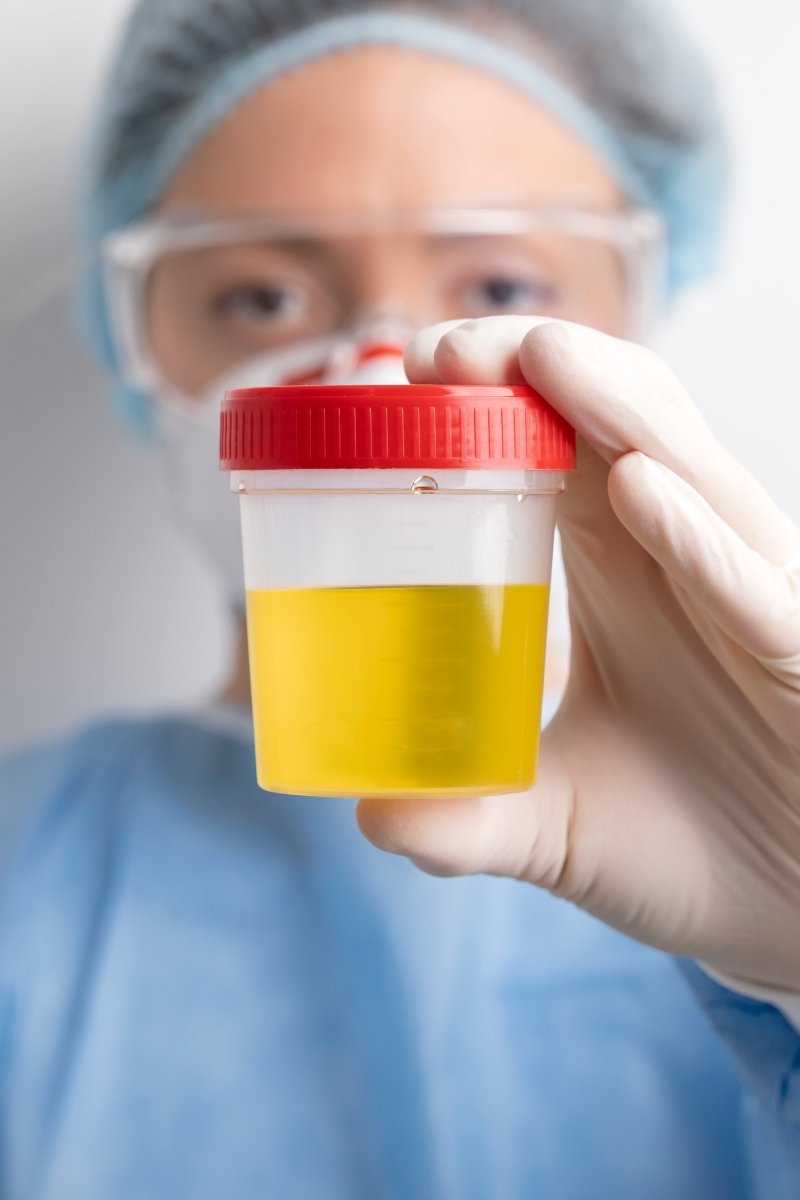 Abnormal Urine pH: What Could It Mean?