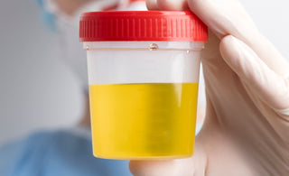 Abnormal Urine pH: What Could It Mean?