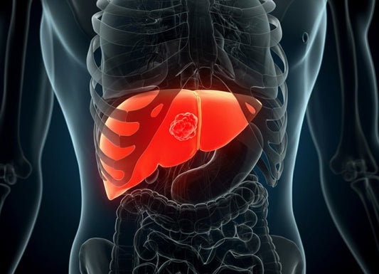 Liver Cancer Survival Rate: What You Need to Know