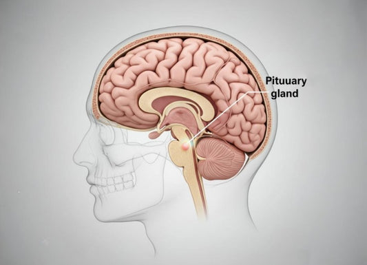 Central diabetes insipidus: What it is and how to manage it