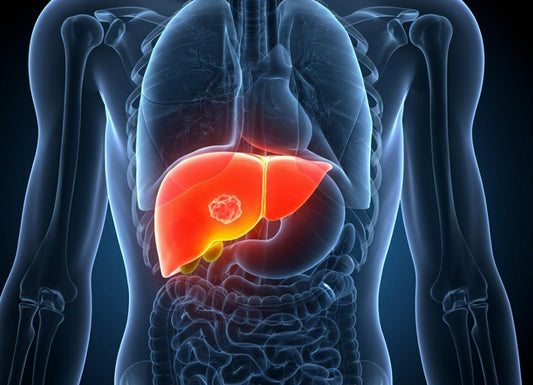Stage 4 Liver Cancer: What You Need to Know