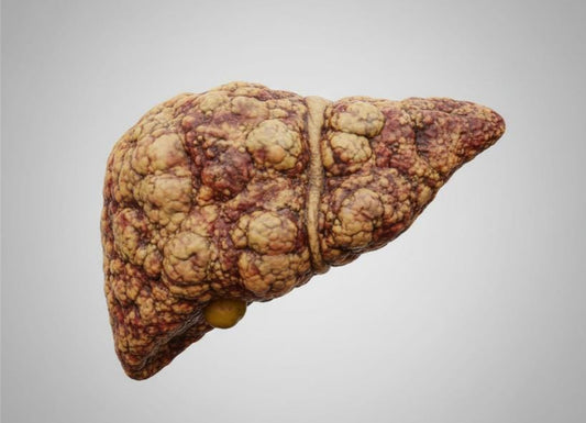 Steatohepatitis: Causes, Symptoms, Diagnosis, and Treatment